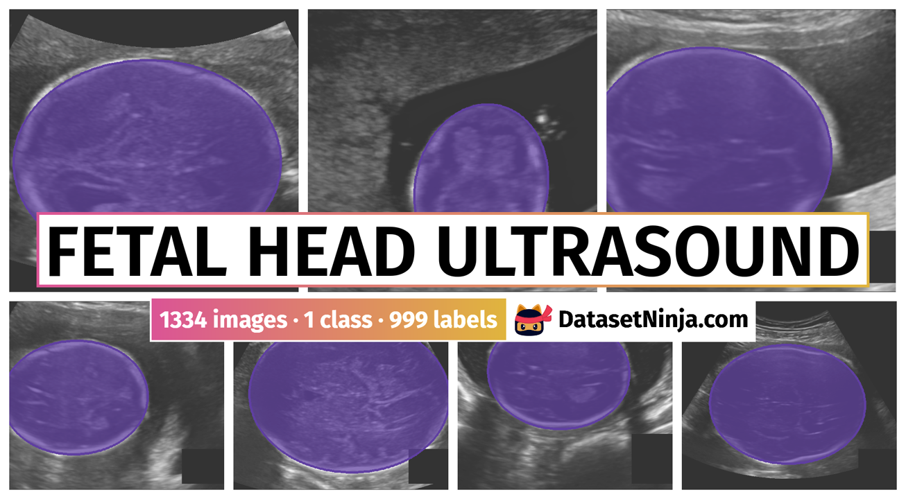 Fetal Head Ultrasound Dataset Ninja 
